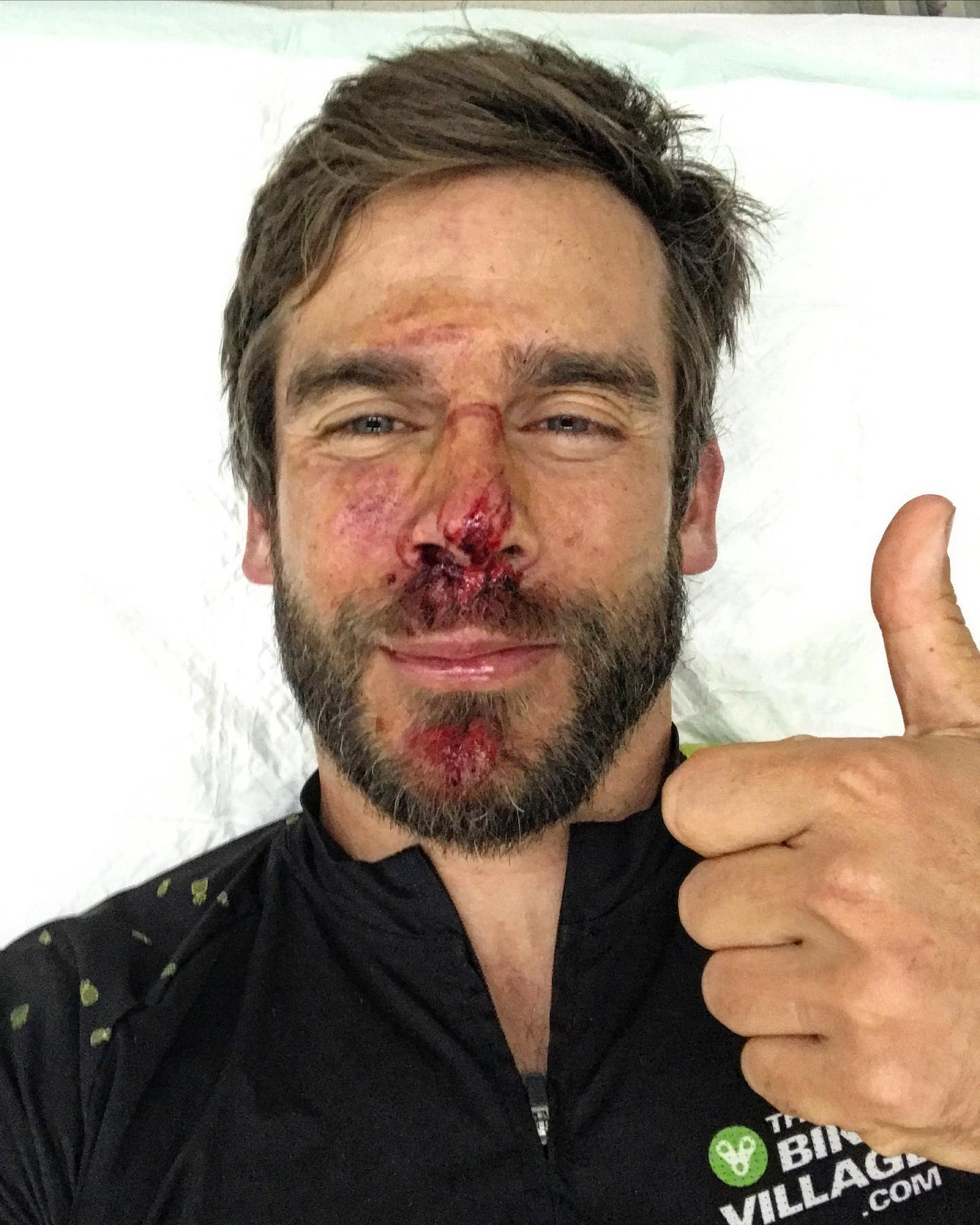 Un ciclista MTB se destroza la cara por una trampa en Barcelona