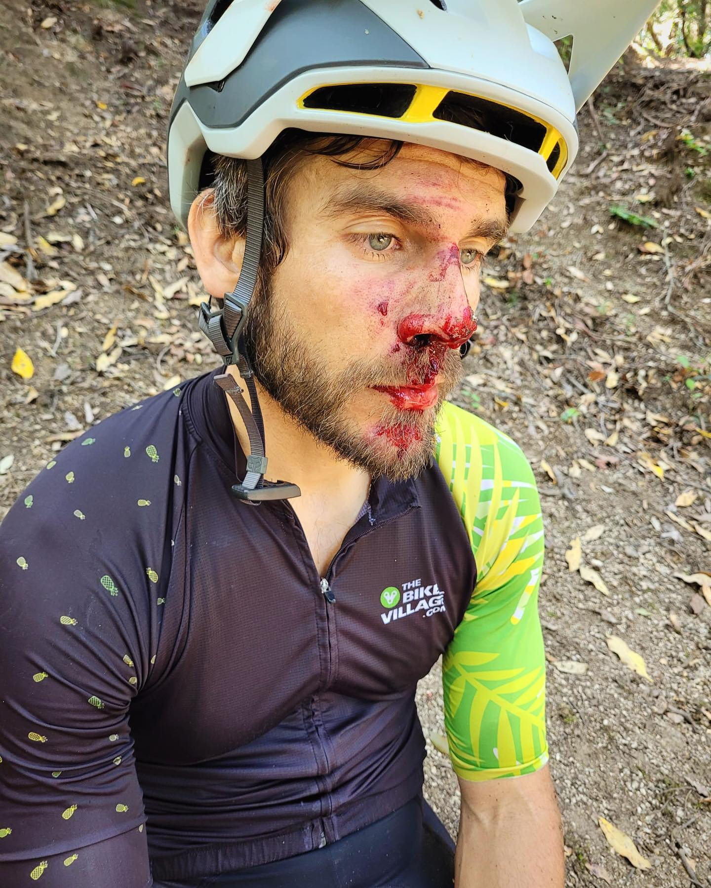 Un ciclista MTB se destroza la cara por una trampa en Barcelona